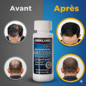 résulats minoxidil kirkland 5
