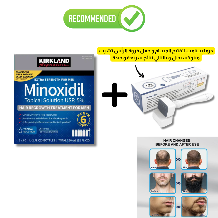 Derma Stamp + minoxidil 5 Derma Stamp + minoxidil 5